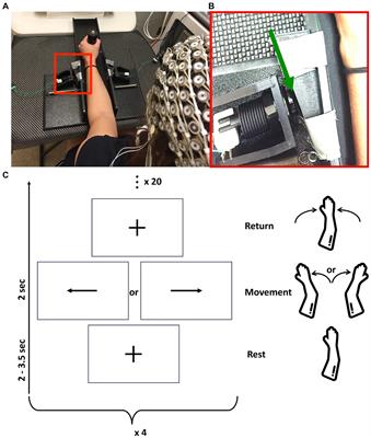 Altered brain function during movement programming is linked with motor deficits after stroke: a high temporal resolution study